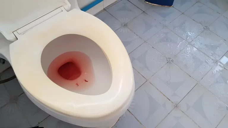 血尿係膀胱炎？一文簡介